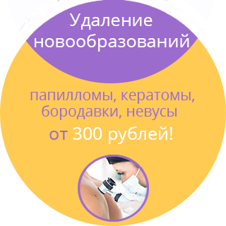 Удаление новообразований