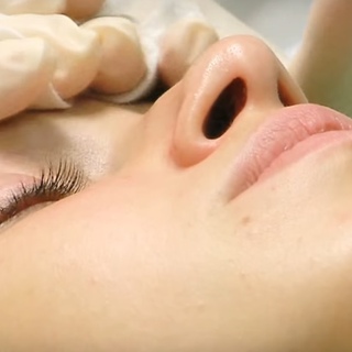 Черные точки